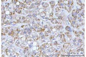 IHC analysis of Hamartin/TSC1 using anti-Hamartin/TSC1 antibody (ABIN7599499). (TSC1 antibody  (AA 1-618))