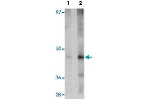 Western blot analysis of rat liver tissue with NR1H3 polyclonal antibody  at (Lane 1) 1 and (Lane 2) 2 ug/mL dilution. (NR1H3 antibody  (N-Term))