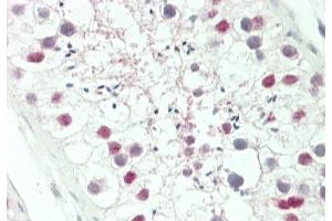 Immunohistochemistry (Paraffin-embedded Sections) (IHC (p)) image for anti-Homeobox A3 (HOXA3) (AA 413-440), (C-Term) antibody (ABIN653846)