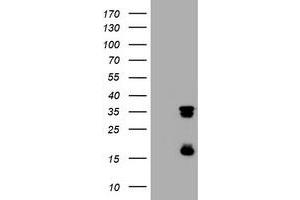 Image no. 1 for anti-Thymidylate Synthetase (TYMS) antibody (ABIN1501598) (TYMS antibody)