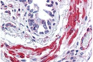 Human Lung, bronchial smooth muscle: Formalin-Fixed, Paraffin-Embedded (FFPE) (Actin antibody  (AA 1-129))