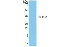Detection of Recombinant FDFT1, Human using Polyclonal Antibody to Farnesyl Diphosphate Farnesyltransferase 1 (FDFT1) (FDFT1 antibody  (AA 269-417))