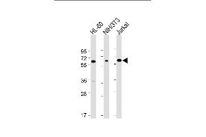 All lanes : Anti-ME2 Antibody (C-term) at 1:4000 dilution Lane 1: HL-60 whole cell lysate Lane 2: NIH/3T3 whole cell lysate Lane 3: Jurkat whole cell lysate Lysates/proteins at 20 μg per lane. (NAD-ME antibody  (C-Term))