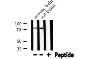 Western blot analysis of PRKCG expression in various lysates (PKC gamma antibody  (Internal Region))