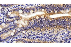Immunohistochemistry (IHC) image for anti-Phosphoinositide-3-Kinase, Catalytic, beta Polypeptide (PIK3CB) (AA 524-703) antibody (ABIN7436744)