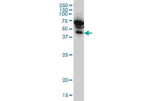 Western Blotting (WB) image for anti-Inhibitor of kappa Light Polypeptide Gene Enhancer in B-Cells, Kinase gamma (IKBKG) (AA 1-110) antibody (ABIN563665)