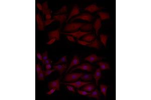 Immunofluorescence analysis of NIH/3T3 cells using MCL1 Rabbit pAb (ABIN3020787, ABIN3020788, ABIN3020789 and ABIN6213724) at dilution of 1:100 (40x lens). (MCL-1 antibody  (AA 120-220))