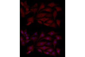 Immunofluorescence analysis of NIH/3T3 cells using MCL1 Rabbit pAb (ABIN3020787, ABIN3020788, ABIN3020789 and ABIN6213724) at dilution of 1:100 (40x lens). (MCL-1 antibody  (AA 120-220))