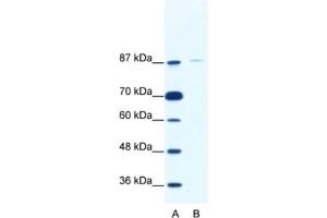 Western Blotting (WB) image for anti-TATA Box Binding Protein (TBP)-Associated Factor, RNA Polymerase I, C, 110kDa (TAF1C) antibody (ABIN2461762) (TAF1C antibody)