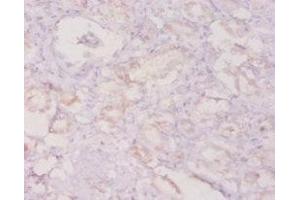 Immunohistochemistry of paraffin-embedded human kidney tissue using ABIN7154394 at dilution of 1:20 (G-CSF antibody  (AA 27-200))