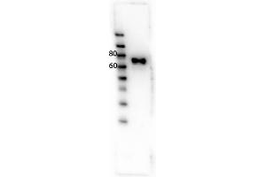 Western Blot of Rabbit anti-RON antibody. (MST1R antibody  (Internal Region, Tyr1353))
