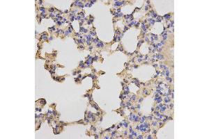 Immunohistochemistry of paraffin-embedded mouse lung using PRKACB antibody. (PRKACB antibody)