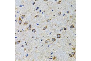 Immunohistochemistry of paraffin-embedded mouse brain using CDK1 antibody. (CDK1 antibody)