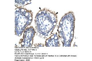 Human Intestine (FLJ20729 (C-Term) antibody)