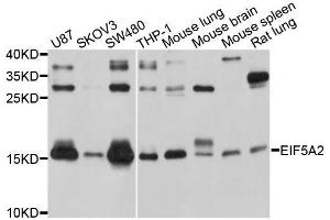 Western blot analysis of extracts of various cell lines, using EIF5A2 antibody. (EIF5A2 antibody  (AA 1-153))