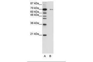 Image no. 1 for anti-Zinc Finger Protein 398 (ZNF398) (C-Term) antibody (ABIN6736187) (ZNF398 antibody  (C-Term))