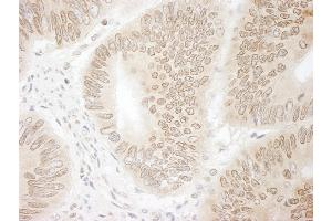 Immunohistochemistry (IHC) image for anti-Denticleless E3 Ubiquitin Protein Ligase Homolog (DTL) (C-Term) antibody (ABIN7448536)