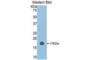 Western Blotting (WB) image for anti-Janus Kinase 2 (JAK2) (AA 689-807) antibody (ABIN1176457)