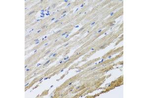 Immunohistochemistry of paraffin-embedded rat heart using SET antibody at dilution of 1:100 (x40 lens). (SET/TAF-I antibody)