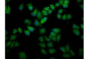 Immunofluorescence staining of Hela cells with ABIN7167644 at 1:166, counter-stained with DAPI. (UPF3B antibody  (AA 319-423))