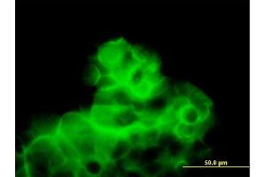 Immunofluorescence of purified MaxPab antibody to CALCR on 293 cell. (Calcitonin Receptor antibody  (AA 1-474))