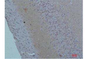 Immunohistochemistry (IHC) analysis of paraffin-embedded Rat Brain Tissue using S100 Rabbit Polyclonal Antibody diluted at 1:200. (S100A1 antibody)
