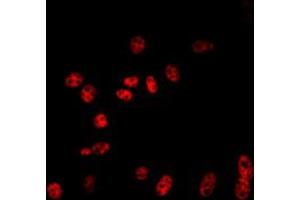 Immunofluorescent analysis of Cullin 2 staining in NIH3T3 cells. (Cullin 2 antibody  (C-Term))