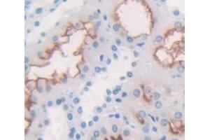 IHC-P analysis of Human Tissue, with DAB staining. (TNS3 antibody  (AA 1-301))