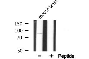 Western blot analysis on mouse brain lysate using Integrin beta-5 Antibody. (Integrin beta 5 antibody  (C-Term))