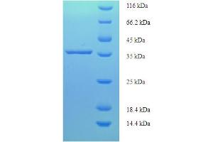 SDS-PAGE (SDS) image for PDZ and LIM Domain 3 (PDLIM3) (AA 1-189) protein (His-SUMO Tag) (ABIN5711375) (PDLIM3 Protein (AA 1-189) (His-SUMO Tag))