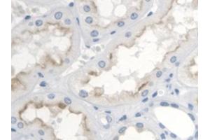 Detection of TP in Human Kidney Tissue using Polyclonal Antibody to Thromboxane Receptor (TP) (TBXA2R antibody  (AA 3-324))