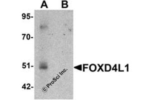 Western Blotting (WB) image for anti-Forkhead Box D4-Like 1 (FOXD4L1) (C-Term) antibody (ABIN1030401) (FOXD4L1 antibody  (C-Term))