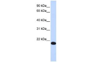 WB Suggested Anti-YAF2 Antibody Titration:  0. (YAF2 antibody  (Middle Region))
