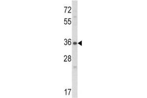 Western blot analysis of Connective Tissue Growth Factor antibody and NCI-H460 lysate. (CTGF antibody  (AA 315-349))