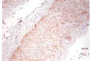 Image no. 1 for anti-Tumor Necrosis Factor alpha (TNF alpha) antibody (ABIN799618) (TNF alpha antibody)
