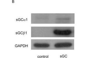 Western Blotting (WB) image for anti-Glyceraldehyde-3-Phosphate Dehydrogenase (GAPDH) antibody (ABIN2857072)