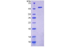SDS-PAGE (SDS) image for Periphilin 1 (PPHLN1) (AA 1-381) protein (His tag) (ABIN4989504) (PPHLN1 Protein (AA 1-381) (His tag))