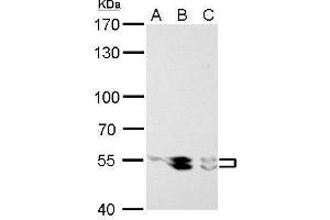 WB Image LYN antibody detects LYN protein by Western blot analysis. (LYN antibody  (Center))