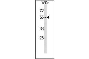 Western blot analysis of NUP50 Antibody (Center) in WiDr cell line lysates (35ug/lane). (NUP50 antibody  (Middle Region))
