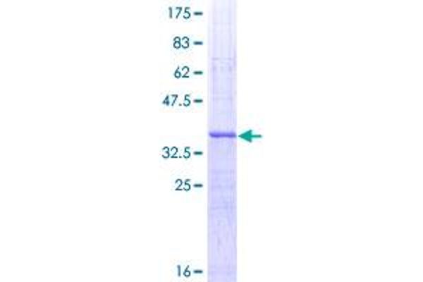 WNT5A Protein (AA 201-300) (GST tag)