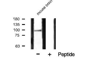Western blot analysis of HSP90B phosphorylation expression in mouse brain tissue lysates,The lane on the right is treated with the antigen-specific peptide.