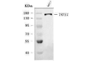 Western blot analysis of TRPS1 using anti-TRPS1 antibody (ABIN7601443).