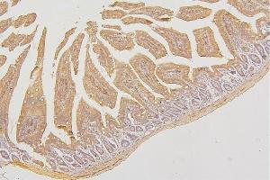 IHC analysis of PRKCD using anti-PRKCD antibody (ABIN7601631).