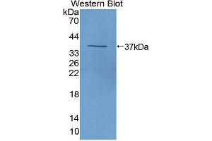 beta-Thromboglobulin antibody  (AA 46-107)