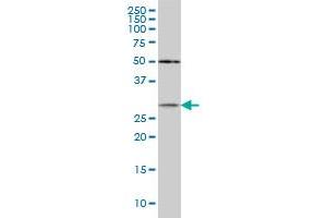 CRYBB1 monoclonal antibody (M03), clone 3D9 Western Blot analysis of CRYBB1 expression in MCF-7 . (CRYBB1 antibody  (AA 37-137))