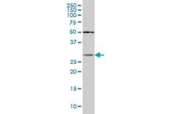 CRYBB1 antibody  (AA 37-137)