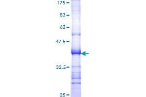 Ataxin 1 Protein (ATXN1) (AA 576-675) (GST tag)