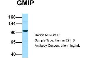 Host: Rabbit Target Name: GMIP Sample Type: Human 721_B Antibody Dilution: 1. (GMIP antibody  (C-Term))
