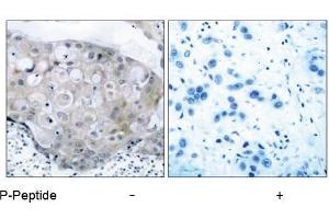 Image no. 1 for anti-VEGF Receptor 2 (VEGFR2) (pTyr951) antibody (ABIN196770) (VEGFR2/CD309 antibody  (pTyr951))