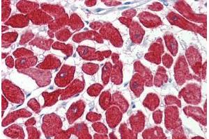 Immunohistochemistry (Paraffin-embedded Sections) (IHC (p)) image for anti-Cardiac Troponin I (TNNI3) (AA 27-40) antibody (ABIN462345)
